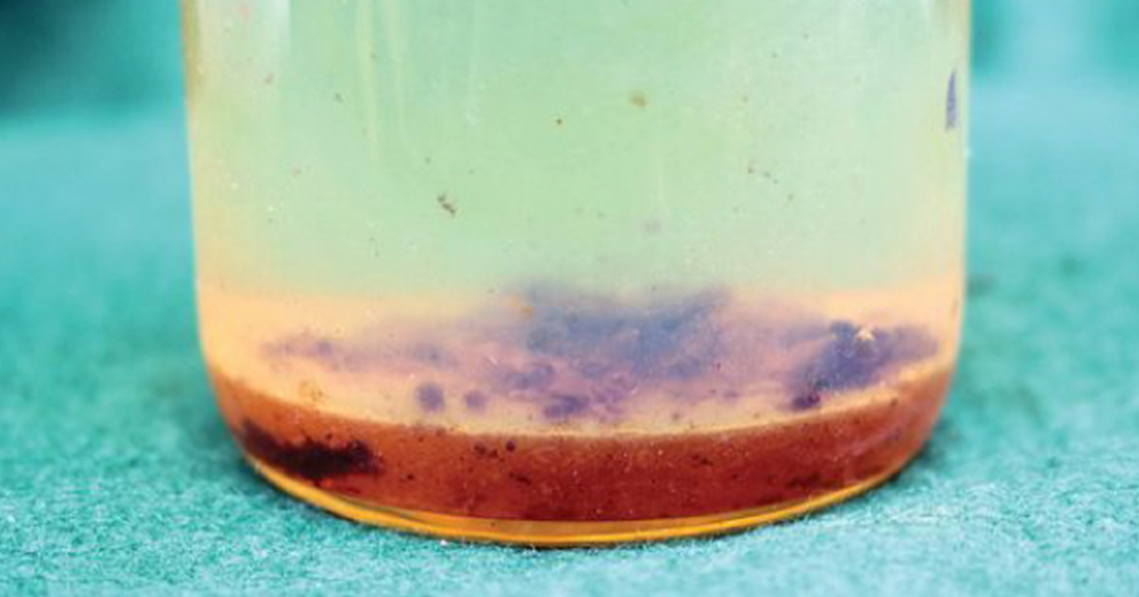 Sample of contaminated oil